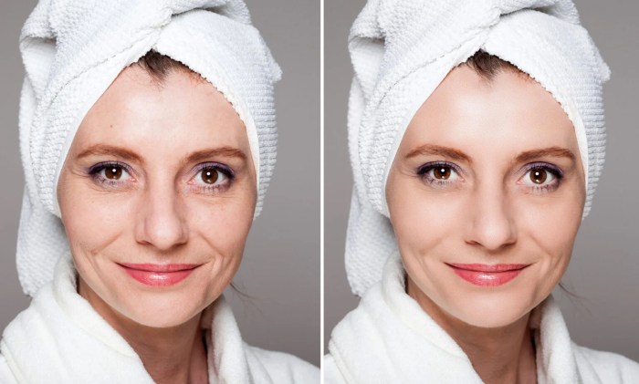 Acne Treatments: Tackling Skin Concerns Worldwide
